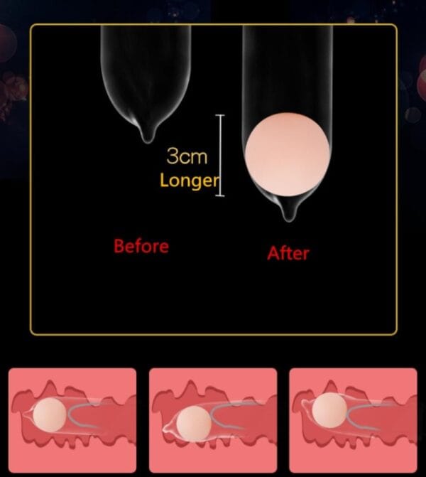 IMG-20230307-WA0046 Esfera