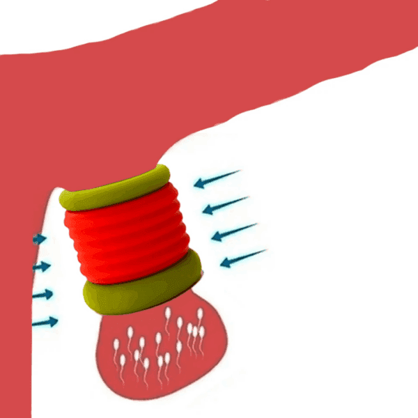 Aro Retardante Texturizado